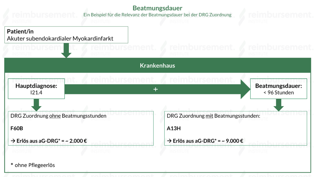 Beatmungsdauer - Darstellung der Relevanz der Beatmungsdauer für die Zuordnung zu einer DRG.